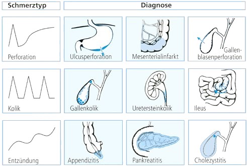 Abb. 82: Schmerztyp ...