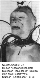 Kopftransplantation eines Affen durch Robert White